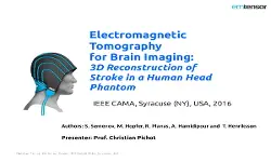 Electromagnetic Tomography for Brain Imaging 3D Reconstruction of Stroke in a Human Head Phantom
